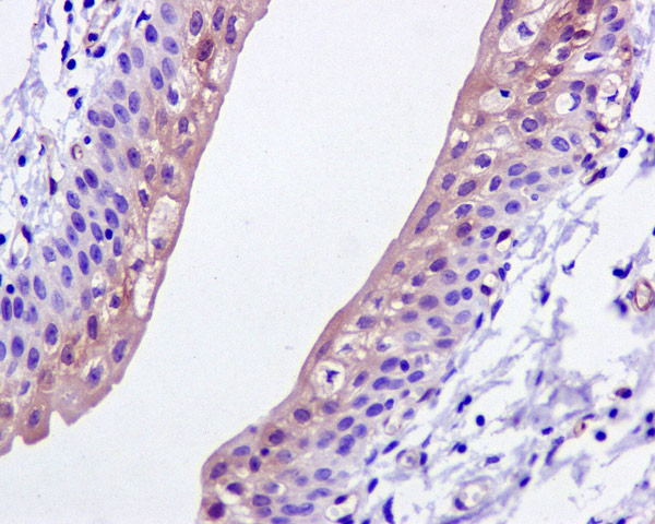 Immunohistochemistry (Formalin/PFA-fixed paraffin-embedded sections) - Anti-ASS1 antibody [EPR12398] (ab170952), expandable thumbnail