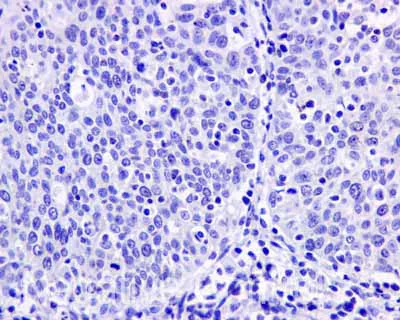 Immunohistochemistry (Formalin/PFA-fixed paraffin-embedded sections) - Anti-ASS1 antibody [EPR12398] (AB170952)
