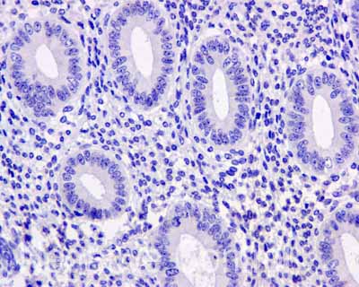 Immunohistochemistry (Formalin/PFA-fixed paraffin-embedded sections) - Anti-ASS1 antibody [EPR12398] (ab170952), expandable thumbnail