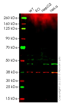 Western blot - Anti-ASS1 antibody [EPR12398] (AB170952)