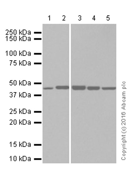 Western blot - Anti-ASS1 antibody [EPR12398] (AB170952), expandable thumbnail