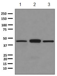 Western blot - Anti-ASS1 antibody [EPR12398] (ab170952), expandable thumbnail