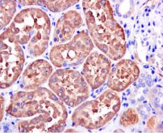 Immunohistochemistry (Formalin/PFA-fixed paraffin-embedded sections) - Anti-ASS1 antibody [EPR12398] - BSA and Azide free (AB231684)