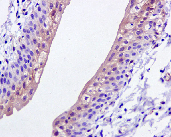 Immunohistochemistry (Formalin/PFA-fixed paraffin-embedded sections) - Anti-ASS1 antibody [EPR12398] - BSA and Azide free (AB231684)
