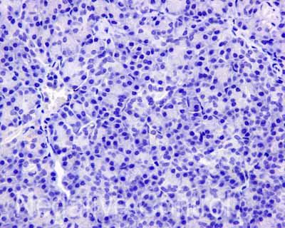Immunohistochemistry (Formalin/PFA-fixed paraffin-embedded sections) - Anti-ASS1 antibody [EPR12398] - BSA and Azide free (AB231684)