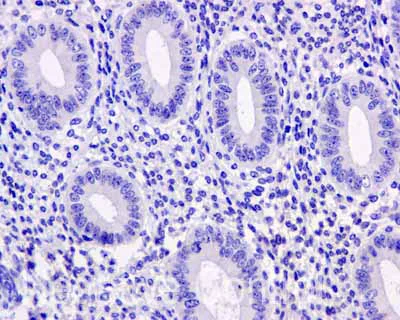 Immunohistochemistry (Formalin/PFA-fixed paraffin-embedded sections) - Anti-ASS1 antibody [EPR12398] - BSA and Azide free (AB231684)