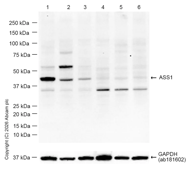 Western blot - Anti-ASS1 antibody [EPR12398] - BSA and Azide free (AB231684)