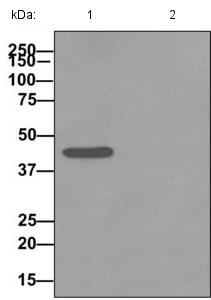 Immunoprecipitation - Anti-ASS1 antibody [EPR12399(B)] - C-terminal (AB170900), expandable thumbnail