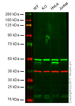 Western blot - Anti-ASS1 antibody [EPR12399(B)] - C-terminal (AB170900), expandable thumbnail