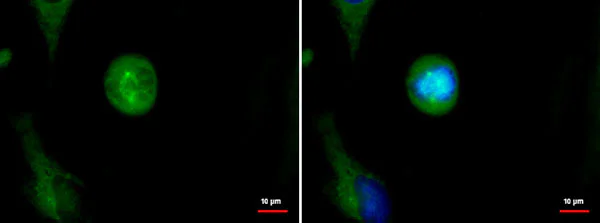 Immunocytochemistry/ Immunofluorescence - Anti-Astrin/Deepest antibody (AB184142)