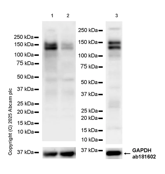 Western blot - Anti-Astrin/Deepest antibody [EPR28134-51] (AB323503)
