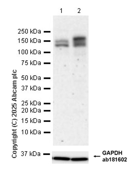 Western blot - Anti-Astrin/Deepest antibody [EPR28134-51] (AB323503), expandable thumbnail