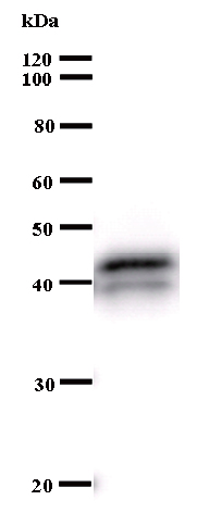 Western blot - Anti-ASXL1 antibody [2049C2a] (AB50817)