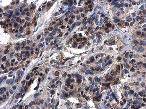 Immunohistochemistry (Formalin/PFA-fixed paraffin-embedded sections) - Anti-ASXL1 antibody - N-terminal (AB228009)