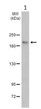 Western blot - Anti-ASXL1 antibody - N-terminal (AB228009)