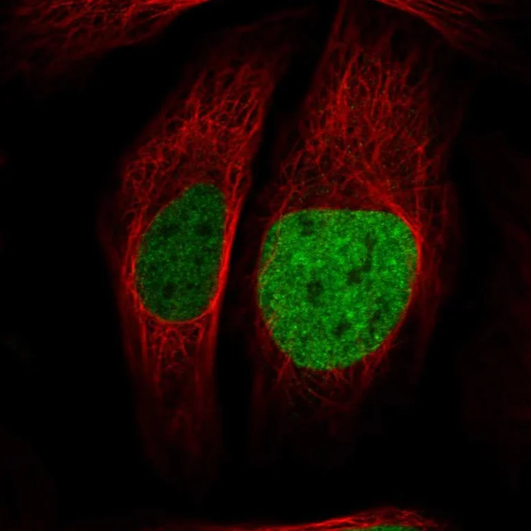 Immunocytochemistry - Anti-ATAD2 antibody (AB244431)