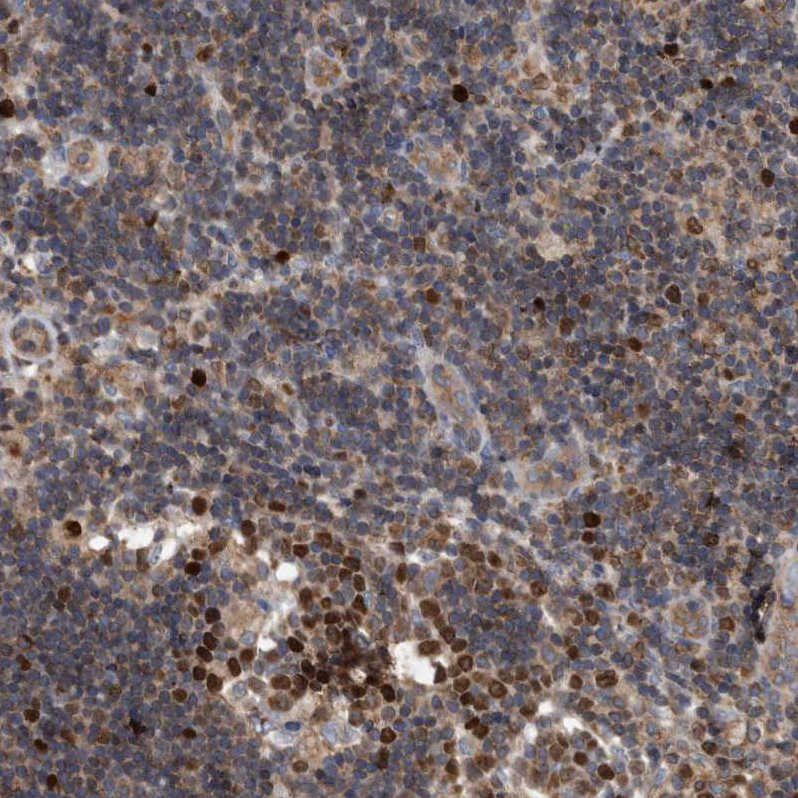 Immunohistochemistry (Formalin/PFA-fixed paraffin-embedded sections) - Anti-ATAD2 antibody (AB244431)