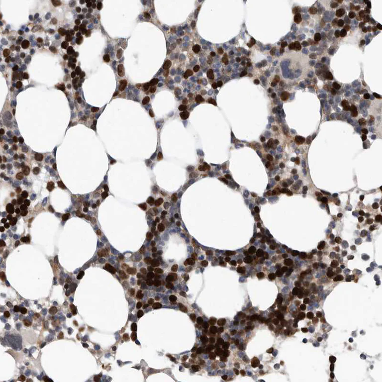 Immunohistochemistry (Formalin/PFA-fixed paraffin-embedded sections) - Anti-ATAD2 antibody (AB244431)