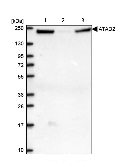 TATアナリシス Stress induced TDP-43 mobility loss independent of stress