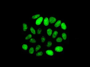 Immunocytochemistry/ Immunofluorescence - Anti-ATAD2 antibody [EPR12730] (AB176319)