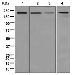 Western blot - Anti-ATAD2 antibody [EPR12730] (AB176319)