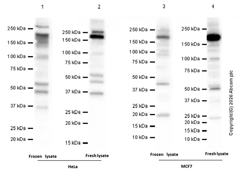 Western blot - Anti-ATAD2 antibody [EPR12730] (AB176319)