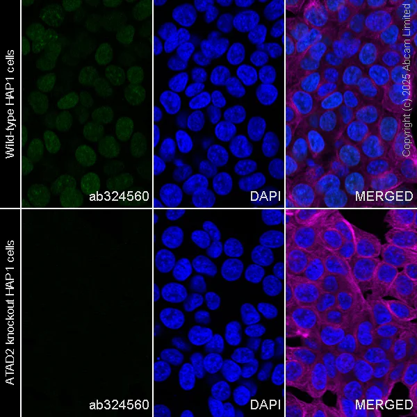 Immunocytochemistry/ Immunofluorescence - Anti-ATAD2 antibody [EPR30238-508] (AB324560)