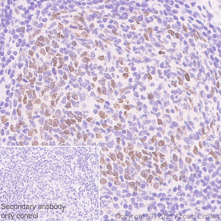 Immunohistochemistry (Formalin/PFA-fixed paraffin-embedded sections) - Anti-ATAD2 antibody [EPR30238-508] (AB324560)