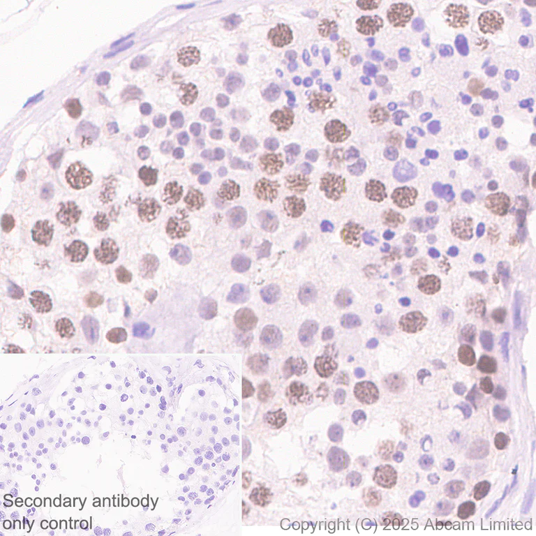 Immunohistochemistry (Formalin/PFA-fixed paraffin-embedded sections) - Anti-ATAD2 antibody [EPR30238-508] (AB324560)