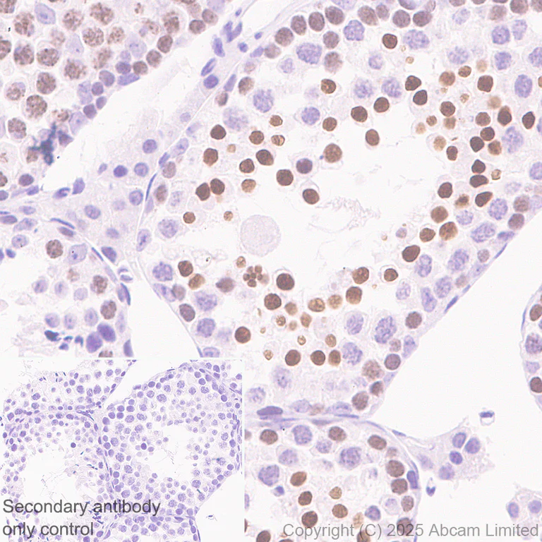 Immunohistochemistry (Formalin/PFA-fixed paraffin-embedded sections) - Anti-ATAD2 antibody [EPR30238-508] (AB324560)
