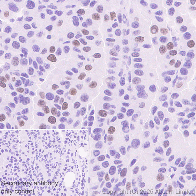 Immunohistochemistry (Formalin/PFA-fixed paraffin-embedded sections) - Anti-ATAD2 antibody [EPR30238-508] (AB324560)