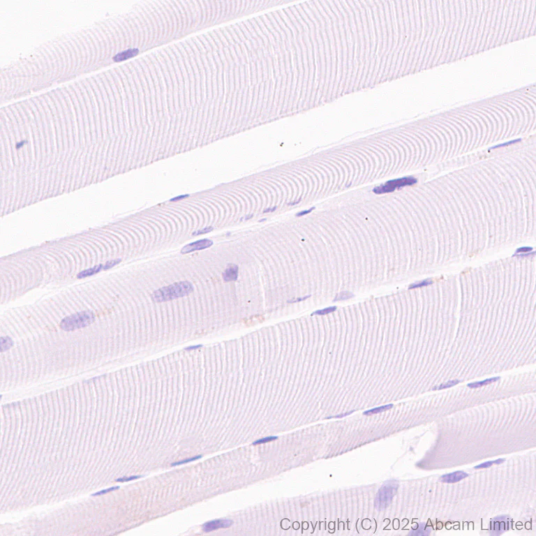 Immunohistochemistry (Formalin/PFA-fixed paraffin-embedded sections) - Anti-ATAD2 antibody [EPR30238-508] (AB324560)