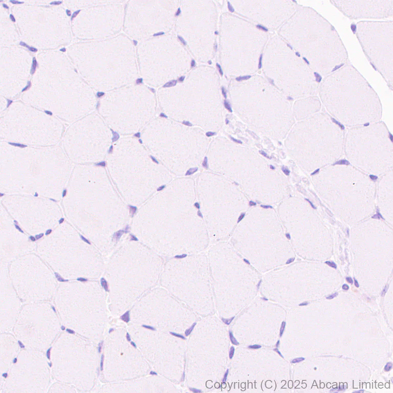 Immunohistochemistry (Formalin/PFA-fixed paraffin-embedded sections) - Anti-ATAD2 antibody [EPR30238-508] (AB324560)