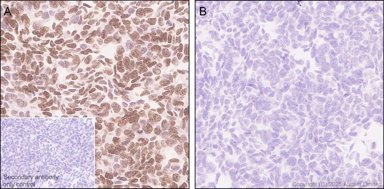 Immunohistochemistry (Formalin/PFA-fixed paraffin-embedded sections) - Anti-ATAD2 antibody [EPR30238-508] (AB324560)