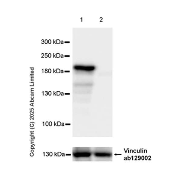 Western blot - Anti-ATAD2 antibody [EPR30238-508] (AB324560)