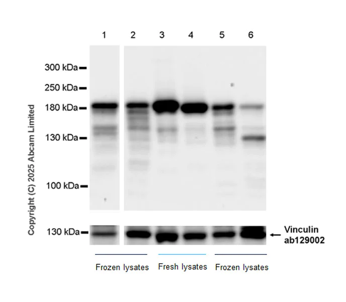 Western blot - Anti-ATAD2 antibody [EPR30238-508] (AB324560)