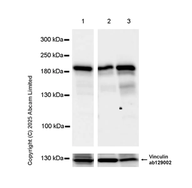 Western blot - Anti-ATAD2 antibody [EPR30238-508] (AB324560)
