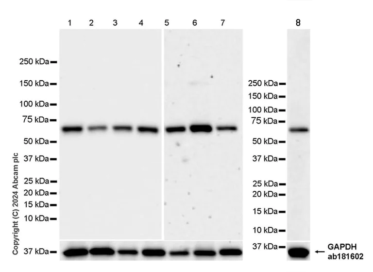 Western blot - Anti-ATAD3A antibody [EPR27484-26] - BSA and Azide free (AB317253)