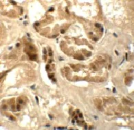 Immunocytochemistry - Anti-ATAD3B antibody (AB112563)