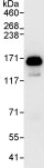 Immunoprecipitation - Anti-Atad5 antibody (AB72111)