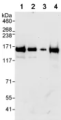 Western blot - Anti-Atad5 antibody (AB72111)