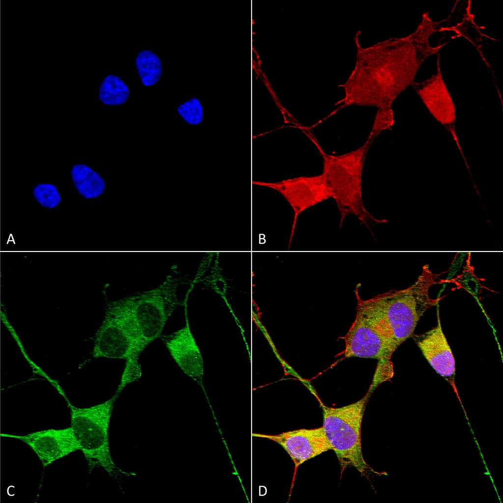 Immunocytochemistry/ Immunofluorescence - Anti-Ataxin 1 antibody [N76/8] (AB186265), expandable thumbnail