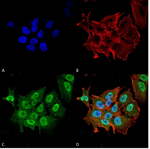 Immunocytochemistry/ Immunofluorescence - Anti-Ataxin 1 antibody [N76/8] (AB186265), expandable thumbnail