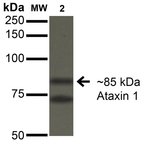 Western blot - Anti-Ataxin 1 antibody [N76/8] (AB186265), expandable thumbnail