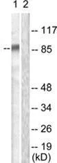 Western blot - Anti-Ataxin 1 (phospho S776) antibody (AB63376)