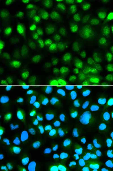 Immunocytochemistry/ Immunofluorescence - Anti-Ataxin 3 antibody (AB175265)