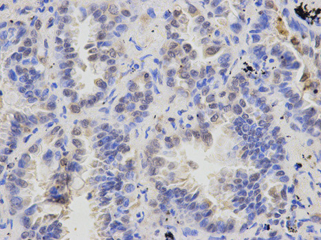 Immunohistochemistry (Formalin/PFA-fixed paraffin-embedded sections) - Anti-Ataxin 3 antibody (AB175265)