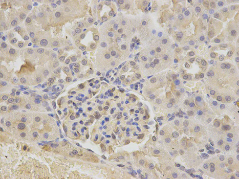 Immunohistochemistry (Formalin/PFA-fixed paraffin-embedded sections) - Anti-Ataxin 3 antibody (AB175265)