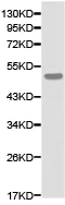 Western blot - Anti-Ataxin 3 antibody (AB175265)