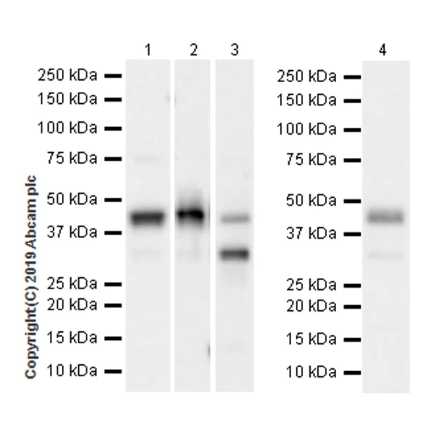 Western blot - Anti-Ataxin 3 antibody [EPR22418-147] (AB221143)